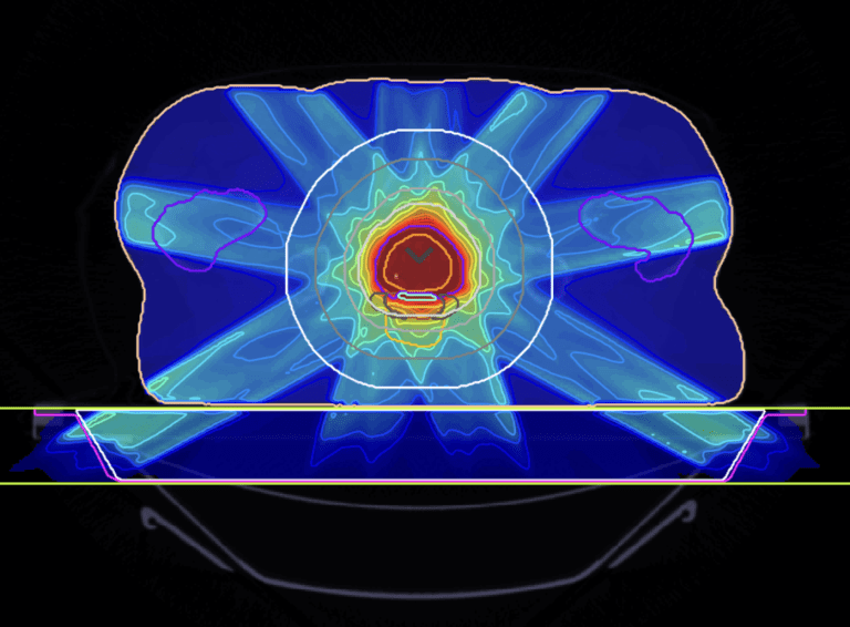 Radiation Therapy Treatment Planning via Inverse Optimization